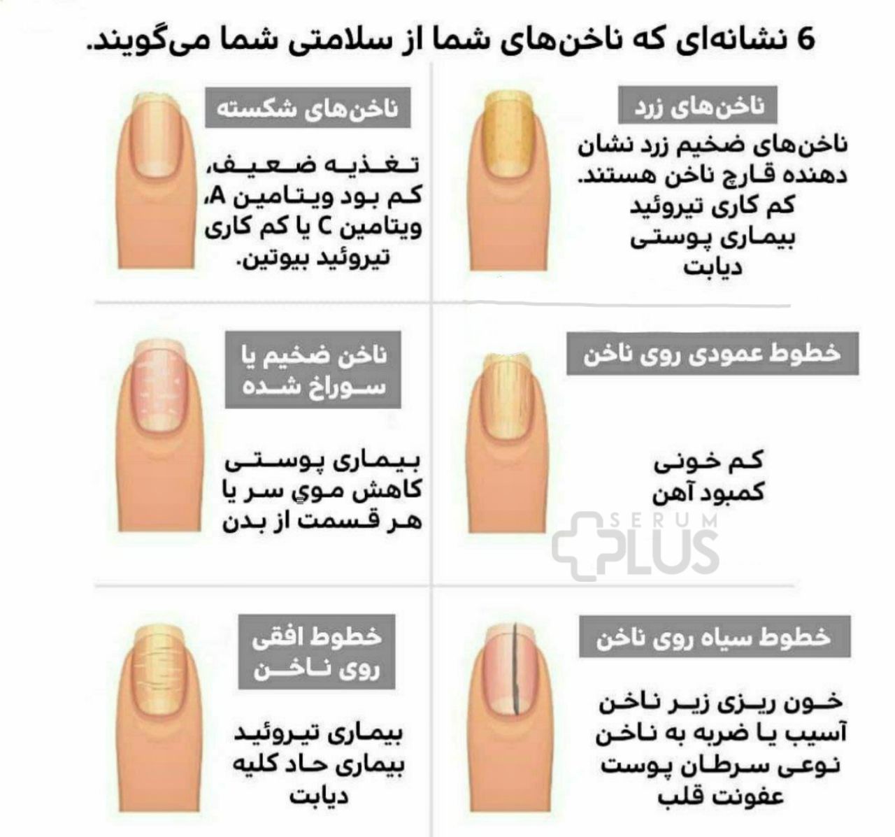 این 6 علامت روی ناخن یعنی بیمار شده‌اید 2