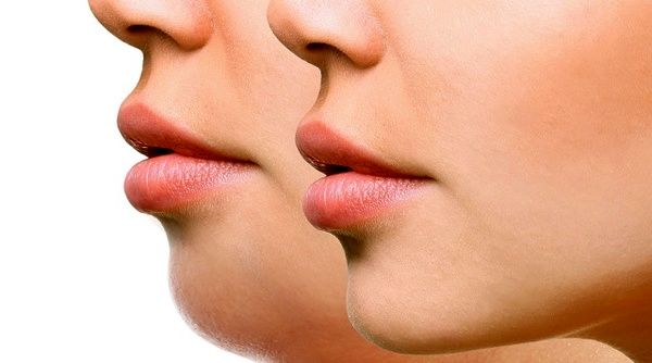 با این روش ها غبغب خود را از بین ببرید